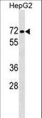 Protein Phosphatase 1 Regulatory Subunit 16B antibody, LS-C158712, Lifespan Biosciences, Western Blot image 