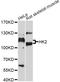 Hexokinase 2 antibody, A0994, ABclonal Technology, Western Blot image 
