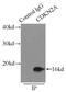 Cyclin-dependent kinase inhibitor 2A, isoforms 1/2/3 antibody, FNab06064, FineTest, Immunoprecipitation image 