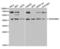 Serpin Family B Member 3 antibody, LS-C335566, Lifespan Biosciences, Western Blot image 