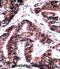 Elongin C antibody, abx028327, Abbexa, Immunohistochemistry paraffin image 