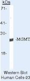 O-6-Methylguanine-DNA Methyltransferase antibody, MA5-13503, Invitrogen Antibodies, Western Blot image 