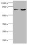 Acyl-CoA Synthetase Long Chain Family Member 4 antibody, A50628-100, Epigentek, Western Blot image 