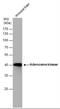 Adenosine Kinase antibody, NBP2-15291, Novus Biologicals, Western Blot image 