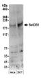 SET Domain Bifurcated Histone Lysine Methyltransferase 1 antibody, NB100-79776, Novus Biologicals, Western Blot image 