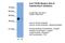 Transforming Growth Factor Beta Induced antibody, PA5-42551, Invitrogen Antibodies, Western Blot image 