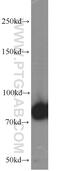 6-phosphofructokinase, muscle type antibody, 55028-1-AP, Proteintech Group, Western Blot image 
