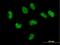 CutC Copper Transporter antibody, H00051076-B01P, Novus Biologicals, Immunocytochemistry image 
