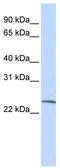 Putative protein SSX6 antibody, TA341511, Origene, Western Blot image 
