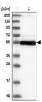 Lactamase Beta antibody, PA5-57627, Invitrogen Antibodies, Western Blot image 