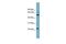 C-Type Lectin Domain Containing 6A antibody, GTX46691, GeneTex, Western Blot image 