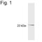 Guanylate Cyclase Activator 1B antibody, NB120-5422, Novus Biologicals, Western Blot image 