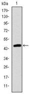 Troponin I2, Fast Skeletal Type antibody, MA5-15911, Invitrogen Antibodies, Western Blot image 