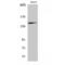 Neurotrophic Receptor Tyrosine Kinase 2 antibody, LS-C386512, Lifespan Biosciences, Western Blot image 