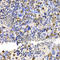 Ubiquitin Conjugating Enzyme E2 V2 antibody, A6998, ABclonal Technology, Immunohistochemistry paraffin image 