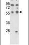 Protein Phosphatase 5 Catalytic Subunit antibody, PA5-15606, Invitrogen Antibodies, Western Blot image 