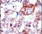 Integrin Linked Kinase antibody, PA5-14680, Invitrogen Antibodies, Immunohistochemistry frozen image 