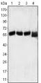 LCK Proto-Oncogene, Src Family Tyrosine Kinase antibody, abx012318, Abbexa, Enzyme Linked Immunosorbent Assay image 
