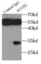 Acyl-CoA Oxidase Like antibody, FNab00097, FineTest, Immunoprecipitation image 