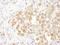 Bifunctional protein NCOAT antibody, NBP2-32233, Novus Biologicals, Immunohistochemistry paraffin image 