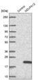 NADH:Ubiquinone Oxidoreductase Subunit A12 antibody, PA5-58973, Invitrogen Antibodies, Western Blot image 