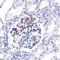 Complement Component 4B (Chido Blood Group), Copy 2 antibody, PA1-39488, Invitrogen Antibodies, Immunohistochemistry frozen image 
