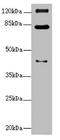 Peroxisomal Biogenesis Factor 3 antibody, LS-C676249, Lifespan Biosciences, Western Blot image 