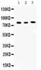 Cyclin T1 antibody, PB9990, Boster Biological Technology, Western Blot image 