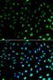 S100 Calcium Binding Protein A8 antibody, LS-C331639, Lifespan Biosciences, Immunofluorescence image 