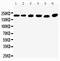 Transient receptor potential cation channel subfamily M member 2 antibody, PA2231, Boster Biological Technology, Western Blot image 