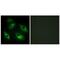 EPH Receptor B6 antibody, PA5-49763, Invitrogen Antibodies, Immunofluorescence image 