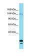 Synapse Defective Rho GTPase Homolog 2 antibody, orb326826, Biorbyt, Western Blot image 