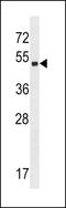 Zinc Finger Protein 559 antibody, LS-C157472, Lifespan Biosciences, Western Blot image 