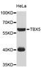 T-Box 5 antibody, STJ25788, St John