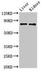 Solute Carrier Family 22 Member 23 antibody, LS-C672528, Lifespan Biosciences, Western Blot image 