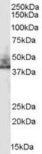 SLC9A3 Regulator 2 antibody, MBS420030, MyBioSource, Western Blot image 