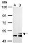 3-Hydroxy-3-Methylglutaryl-CoA Synthase 2 antibody, GTX128013, GeneTex, Western Blot image 