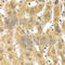 Snail Family Transcriptional Repressor 2 antibody, A1057, ABclonal Technology, Immunohistochemistry paraffin image 