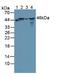 Branched Chain Keto Acid Dehydrogenase Kinase antibody, MBS2028641, MyBioSource, Western Blot image 