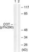 Mitogen-Activated Protein Kinase Kinase Kinase 8 antibody, LS-C198825, Lifespan Biosciences, Western Blot image 
