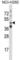 TNF Receptor Superfamily Member 10a antibody, abx027548, Abbexa, Western Blot image 