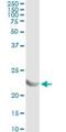 Adenylate Kinase 1 antibody, H00000203-M06, Novus Biologicals, Immunoprecipitation image 