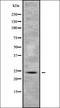 RAB5B, Member RAS Oncogene Family antibody, orb338630, Biorbyt, Western Blot image 