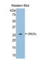 TNF Receptor Superfamily Member 21 antibody, LS-C301190, Lifespan Biosciences, Western Blot image 