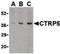 C1q And TNF Related 5 antibody, GTX85671, GeneTex, Western Blot image 