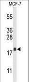 Anterior Gradient 3, Protein Disulphide Isomerase Family Member antibody, LS-C156160, Lifespan Biosciences, Western Blot image 