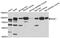 Interleukin 1 Receptor Associated Kinase 1 antibody, A12624, ABclonal Technology, Western Blot image 