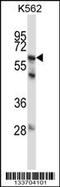 Matrix Metallopeptidase 11 antibody, 57-228, ProSci, Western Blot image 