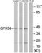 G Protein-Coupled Receptor 34 antibody, TA313952, Origene, Western Blot image 