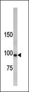 LLGL Scribble Cell Polarity Complex Component 1 antibody, 61-207, ProSci, Western Blot image 